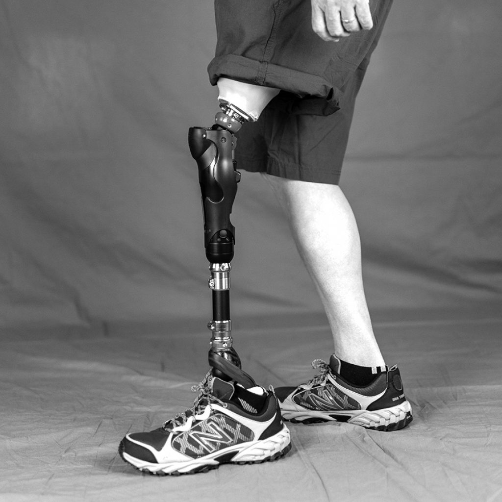 prosthetics-is-hd